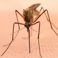 Zika And Expecting Mothers