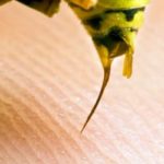 4 Ways To Reduce The Threat Of Bee And Wasp Stings