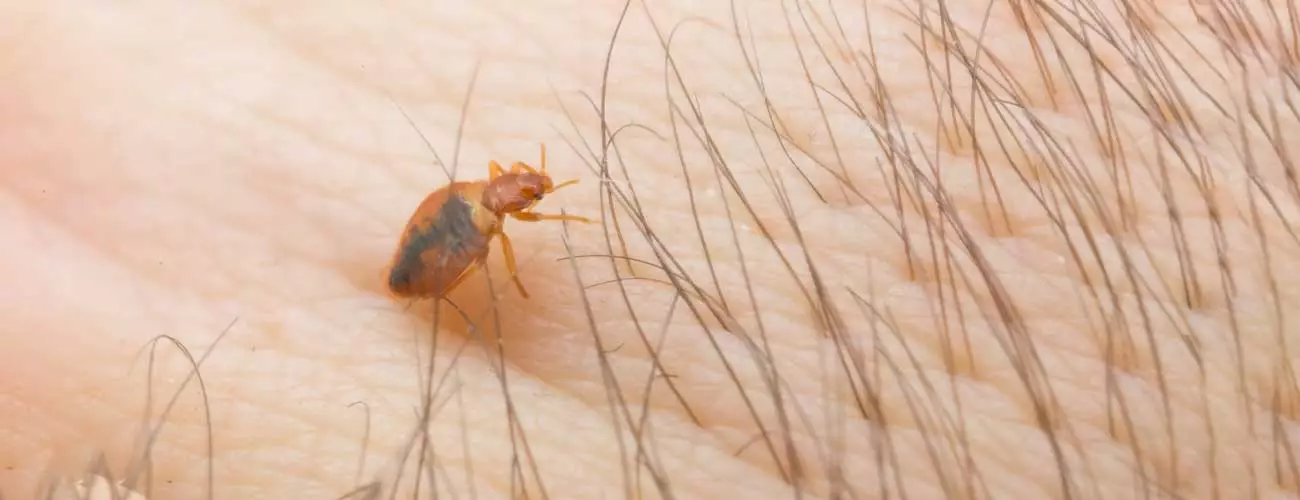 Bed bug close up on skin with hair