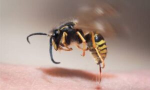 a wasp midway into stinging a human's arm